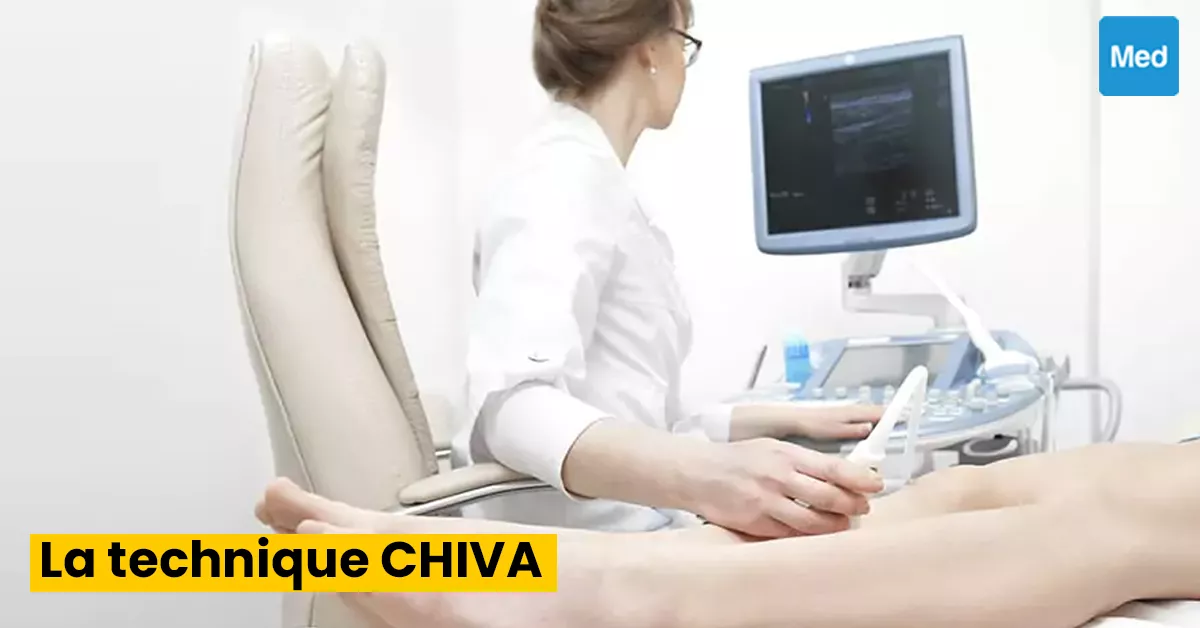 La technique CHIVA : une alternative à la chirurgie des varices